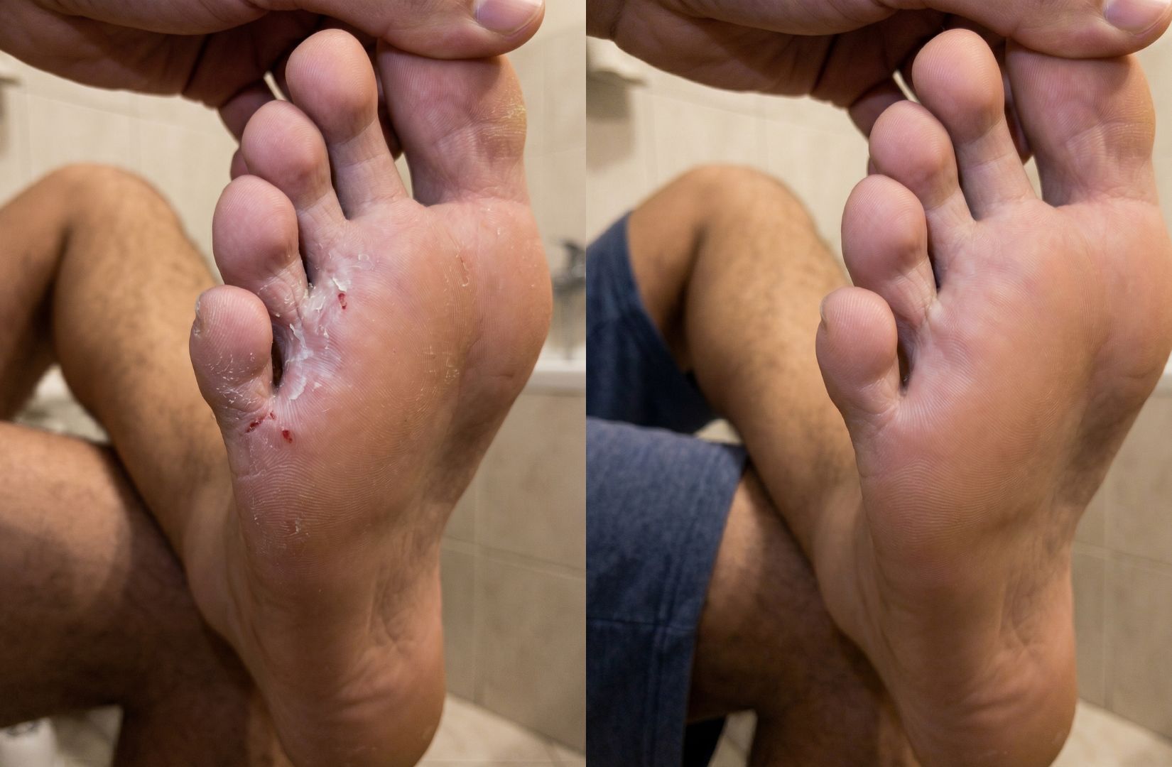 Antes e depois do tratamento com Blend Fungicida